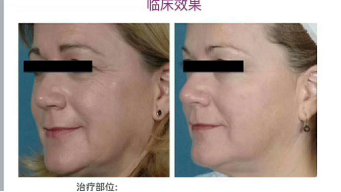 wps102.tmp.png wps102.tmp.png