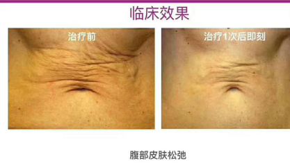 wps105.tmp.png wps105.tmp.png