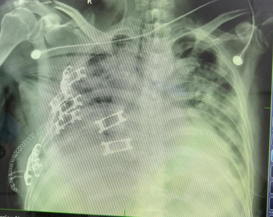 QQ圖片20200817165624.png QQ圖片20200817165624.png