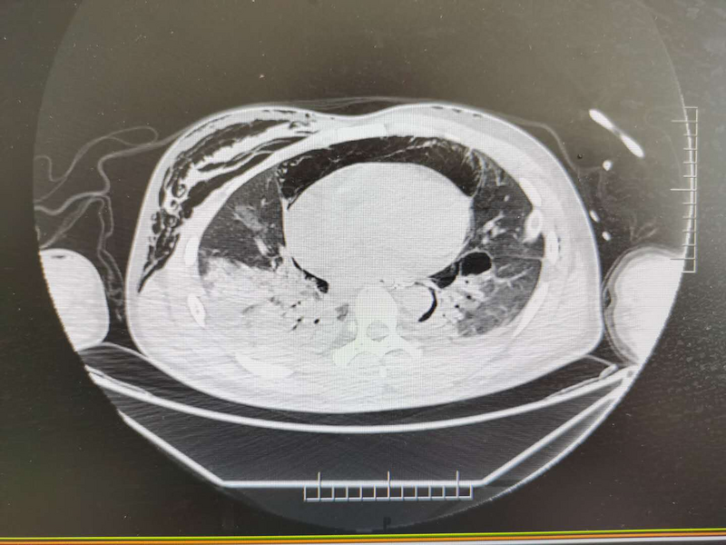 QQ圖片20200914155808.png QQ圖片20200914155808.png