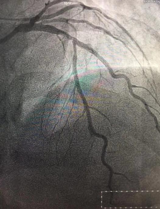 圖片22.png 圖片22.png