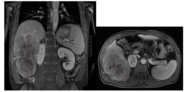 QQ圖片20220506161756.png QQ圖片20220506161756.png