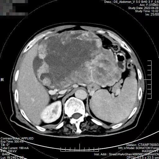 微信圖片_20220517165408.jpg 微信圖片_20220517165408.jpg