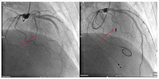 QQ截圖20240617090348.jpg QQ截圖20240617090348.jpg